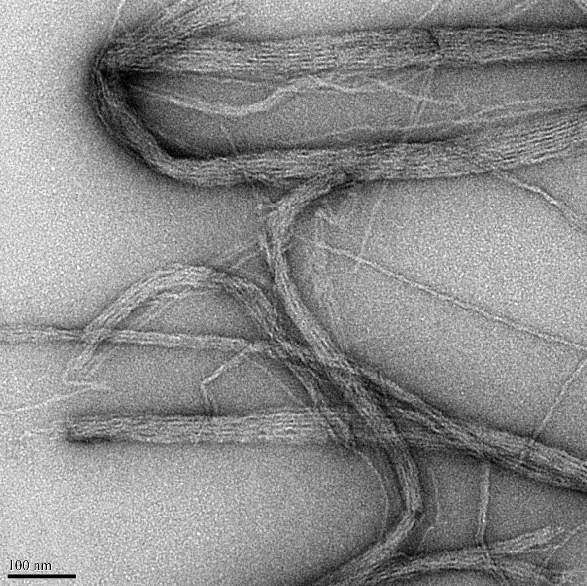 <multi>[fr]Colorant : UrAc 2% (collaboration : V. Forge, IRIG)[en]Stain : UrAc 2% (collaboration : V. Forge, IRIG)</multi>