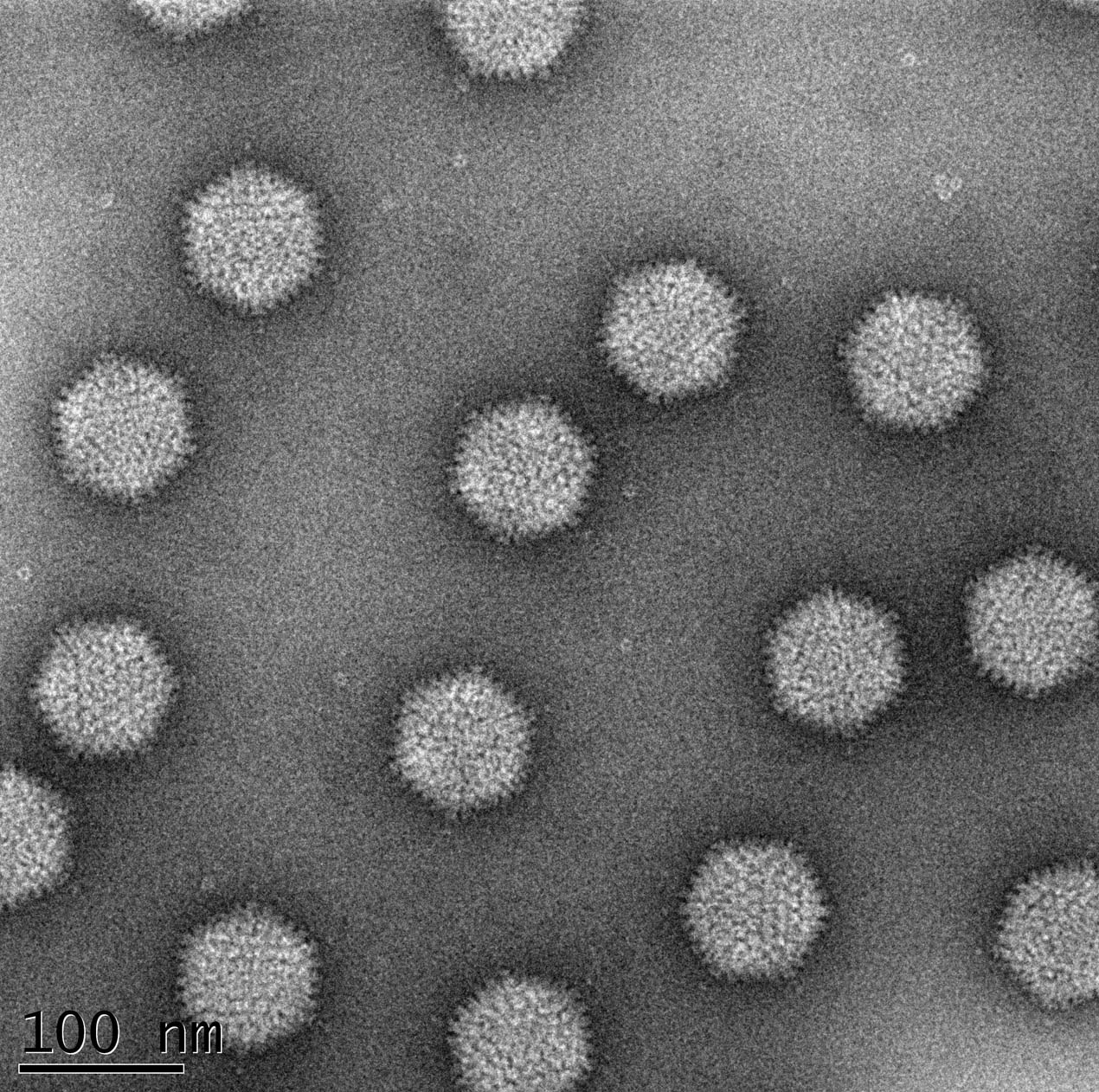 <multi>[fr]Colorant : UrAc 2% (P. Fender)[en]Stain : UrAc 2% (P. Fender)</multi>